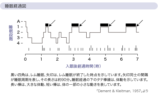 睡眠経過図