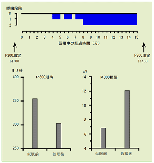 図1　短時間仮眠による脳のリフレッシュ効果